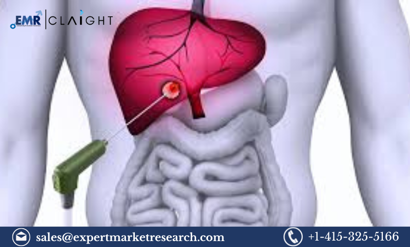 Asia Pacific Tumor Ablation Market